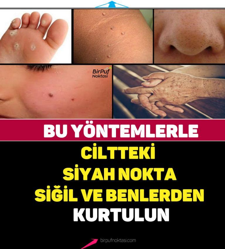 HAYAT A 11742 P f Noktas 